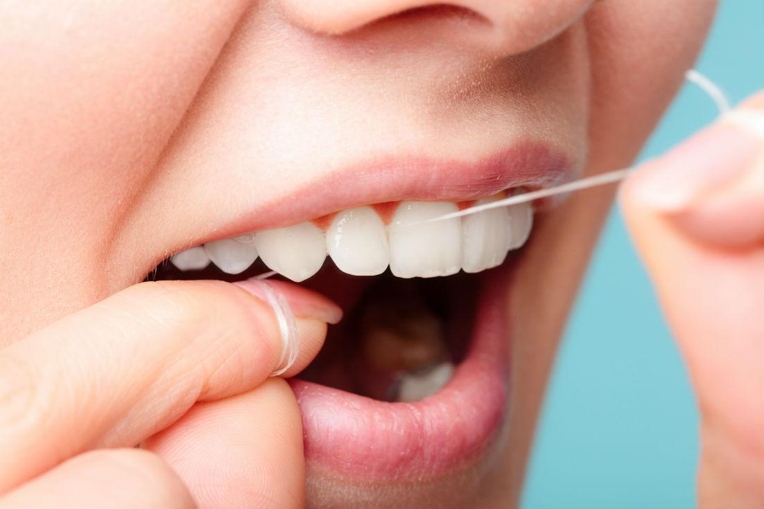 Is Flossing Your Teeth Really Important?