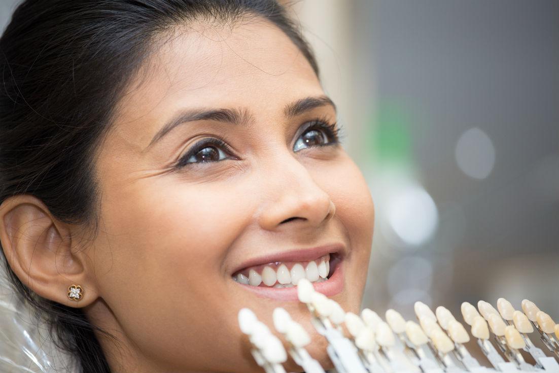 Differences Between Dental Bonding and Veneers